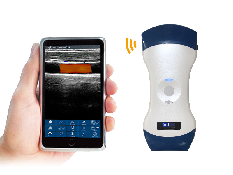 User's Guide(IFU) of Cprobe