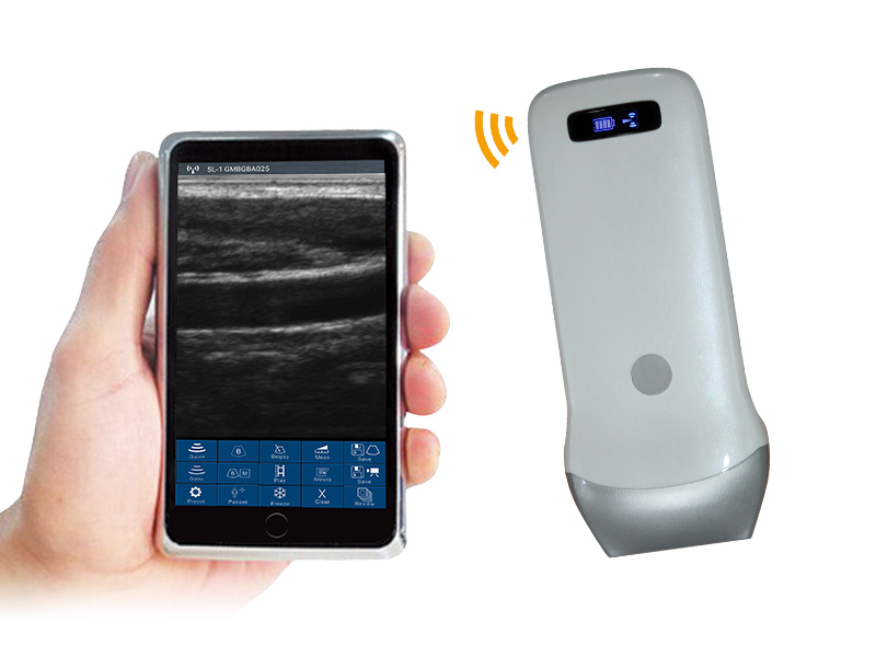 User's Guide(IFU) of Uprobe