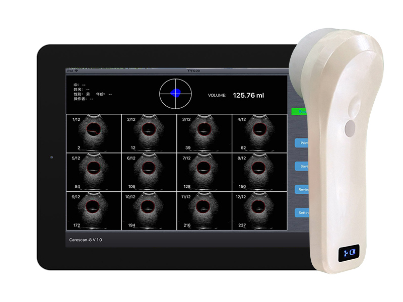 BProbe-2 4D Wireless Bladder Scanner