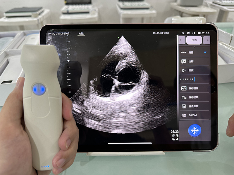 5PA phased array palm doppler ultrasound scanner(with CW)