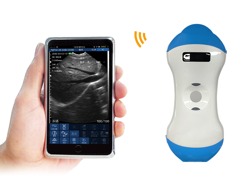 CProbe-CL Plus 2in1 palm doppler ultrasound scanner