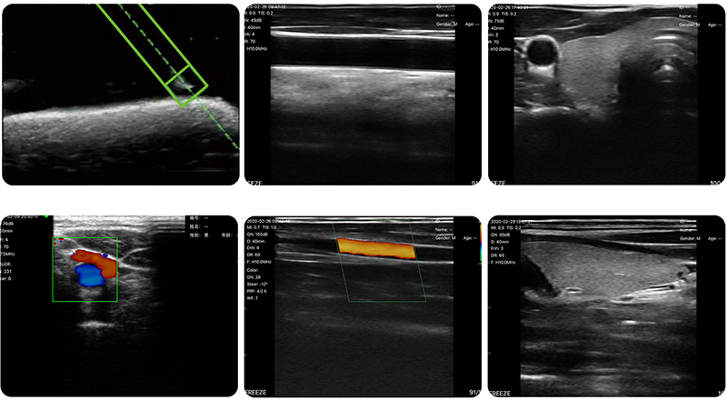 0.jpg